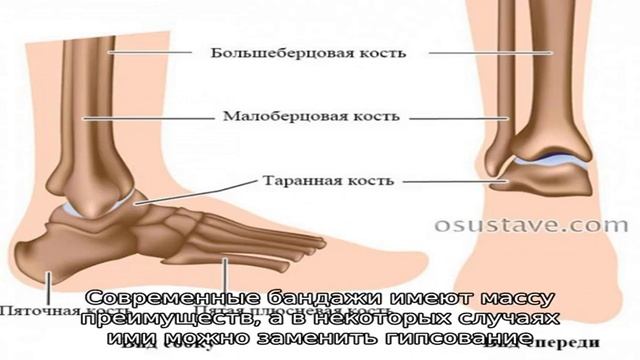 Бандажи для голеностопных суставов смотреть онлайн