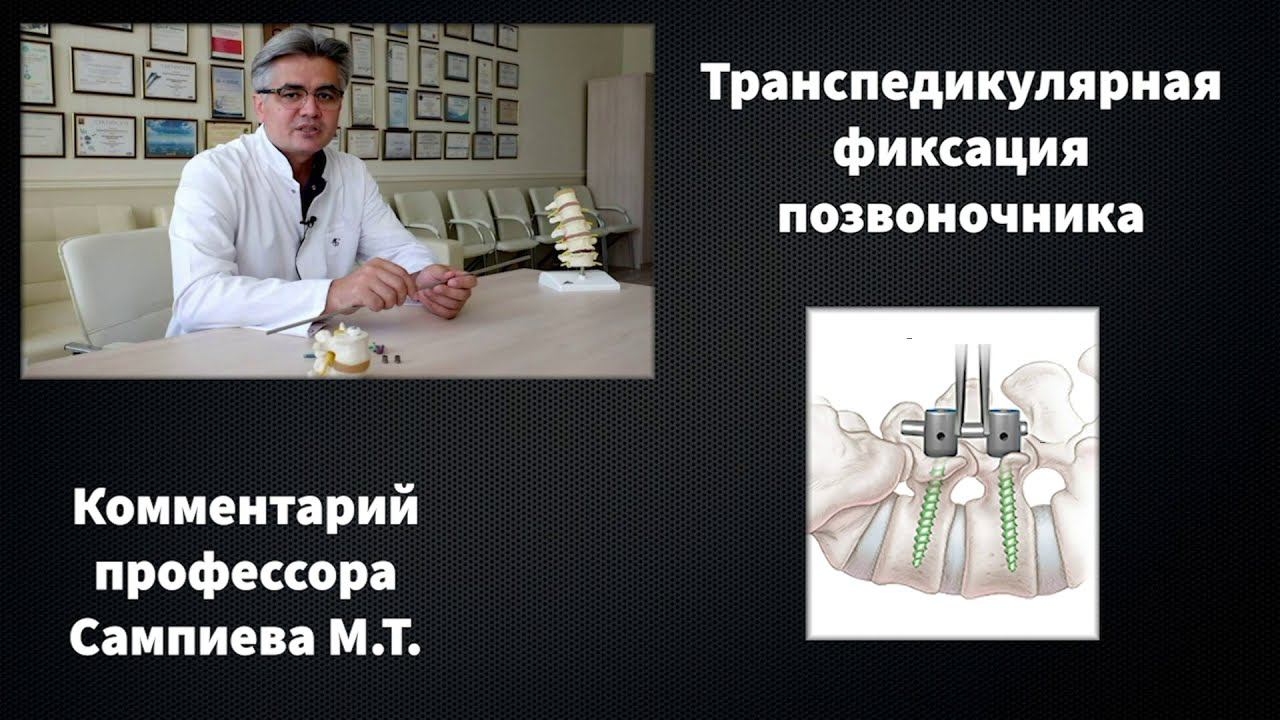 Транспедикулярная фиксация позвоночника титановой системой смотреть онлайн
