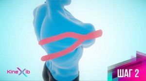 Kinexib - тейпирование подлопаточной мышцы