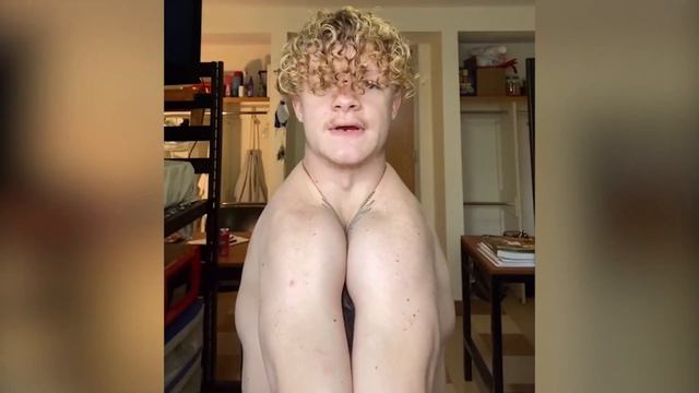 Парень с редким заболеванием снимает жуткие видео смотреть онлайн