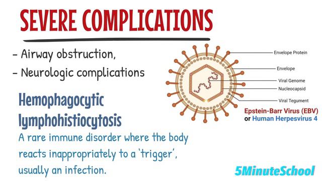 What is the Epstein-Barr Virus? -  2 Minute RAPID REVIEW