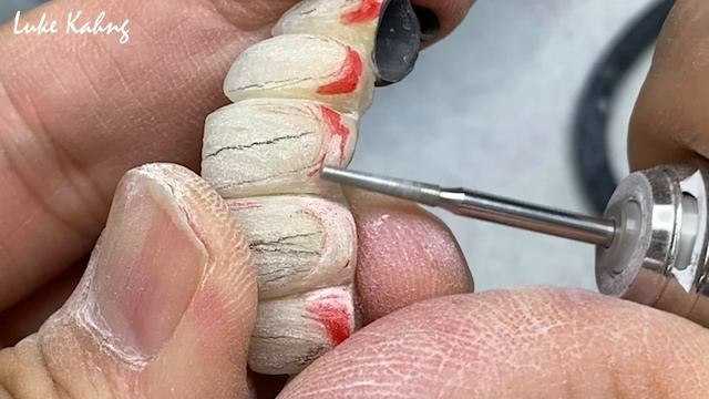 How to make Metal Ceramic Ball Attachments for Future Partials смотреть онлайн