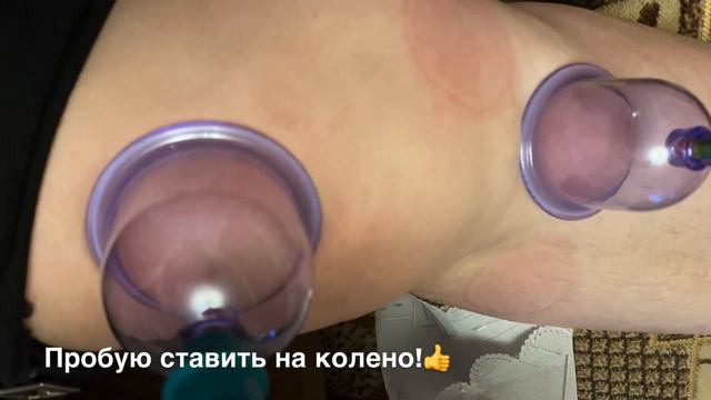 Вакуумные банки!👍😊 Покупка по интернету/Распаковка посылки!￼👍😊 смотреть онлайн