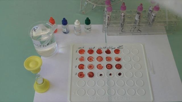 Определение группы крови и резус принадлежности цоликлонами