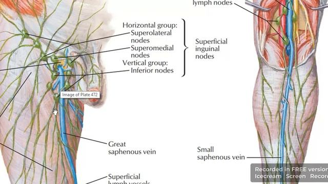 Superficial inguinal lymph nodes 3 смотреть онлайн