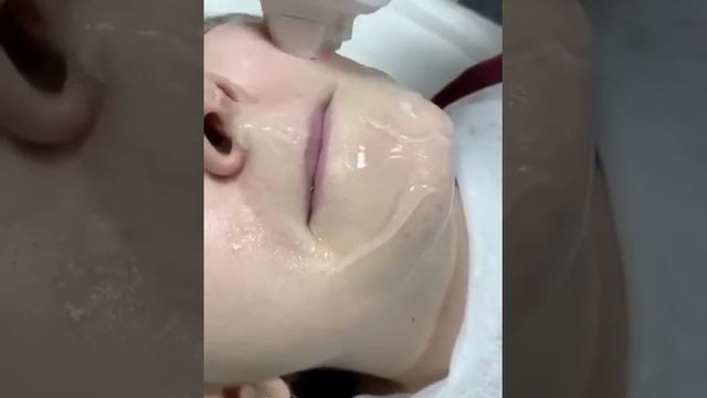 Лазерная эпиляция усиков Краснодар смотреть онлайн