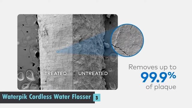 Best Water Flosser for Family - Best Water Flosser You Can Buy on Amazon смотреть онлайн