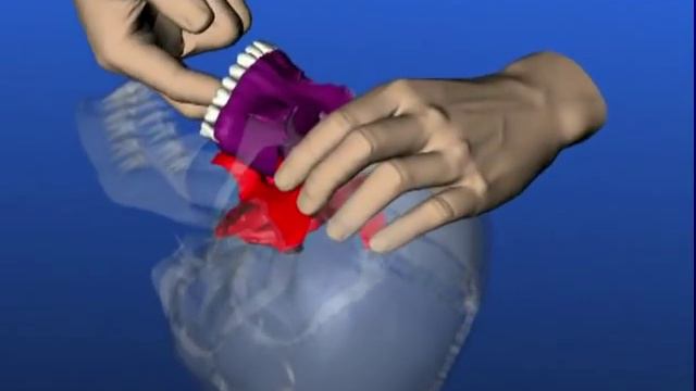 Craniosacral Osteopathy (english Version)- Clearly Demonstrated