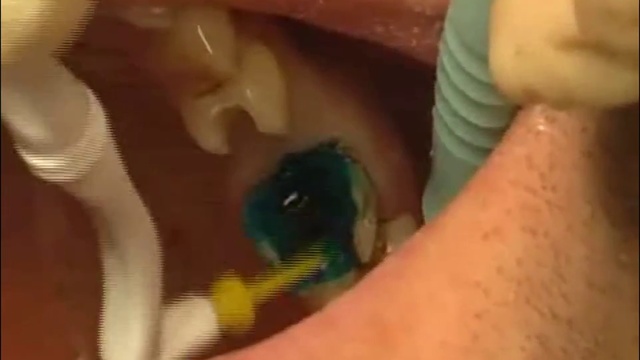 объединить обесцвечивание