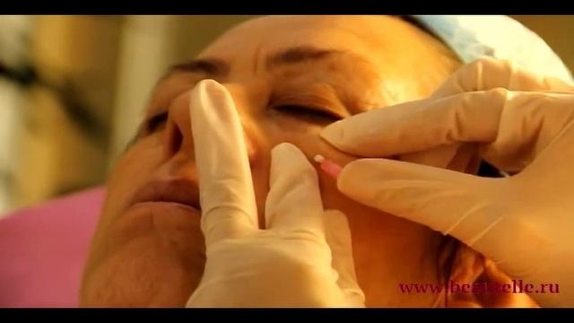 Омолаживающие нити. Салон Бьютэлль. смотреть онлайн