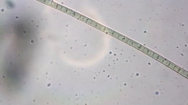 микробы под микроскопом смотреть онлайн