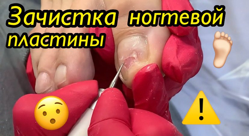 Зачистка ногтевой пластины ????⚠️❗️ смотреть онлайн