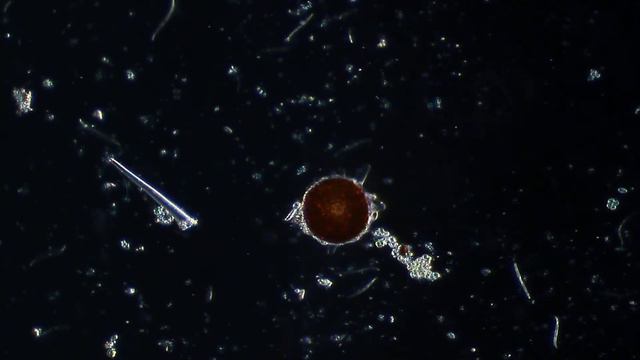 Arcella sp. (Testate amoeba) - Protozoans and other small critters смотреть онлайн