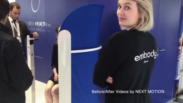DEKA at IMCAS 2017. D-Glow treatment. смотреть онлайн