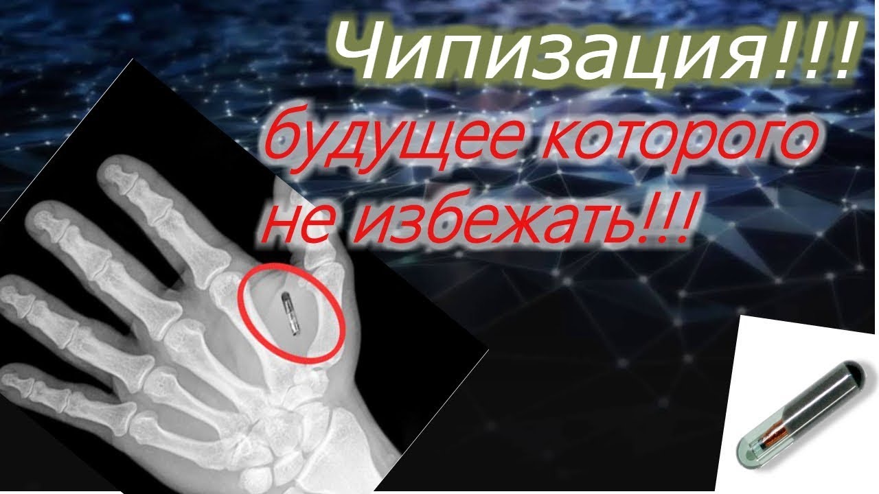 Чипизация !!! Будущее которого нам не избежать!!! смотреть онлайн