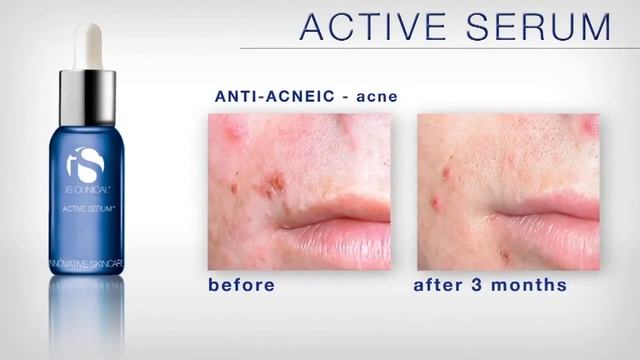 ACTIVE SERUM смотреть онлайн