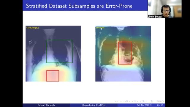 Reproducibility Challenge: Re-implementation of CheXNet using TensorFlow смотреть онлайн
