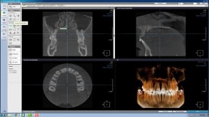 OnDemand3D™  базовые навыки работы в программе