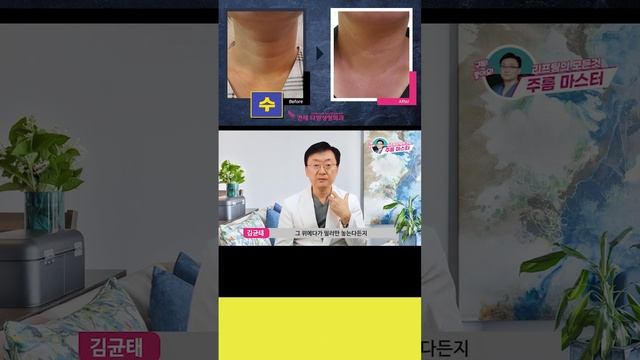 #shorts 가로목주름 수술의 핵심은 유착방지 #목주름 #김균태원장 #neck #neckline смотреть онлайн
