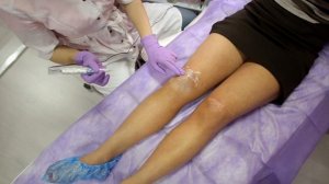 Камуфляж (татуаж) перекрытие рубцов