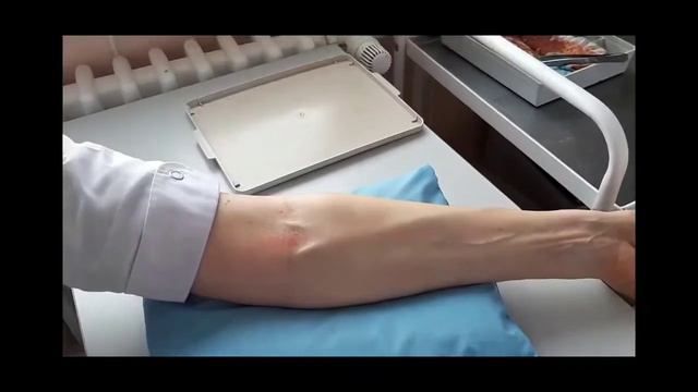 инъекция Эссенциале смотреть онлайн