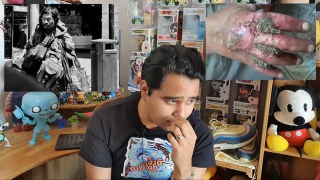 Videos reales de TRIPOFOBIA terrorificos ¿Eres apto para ver este Test? смотреть онлайн