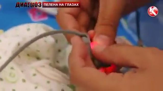 Диагноз Пелена на глазах смотреть онлайн