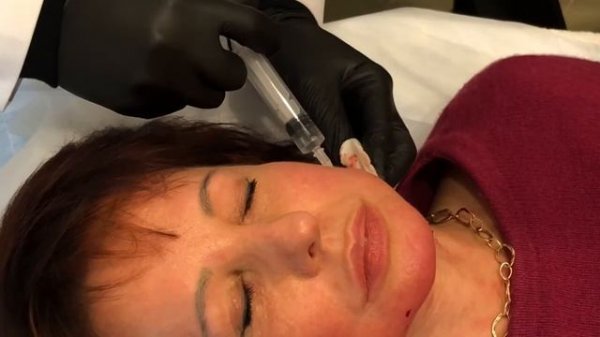 Липолитик V-Line