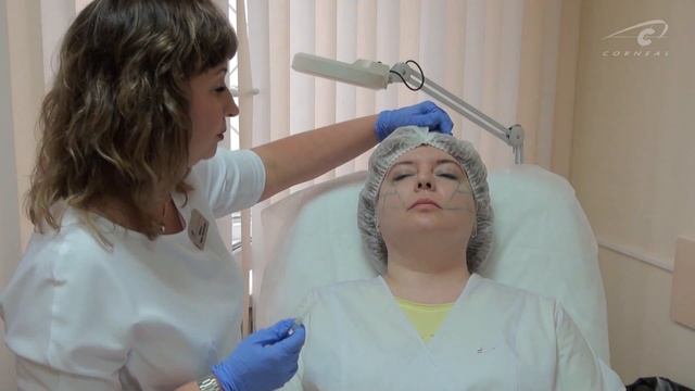 Коррекция скул иглой смотреть онлайн