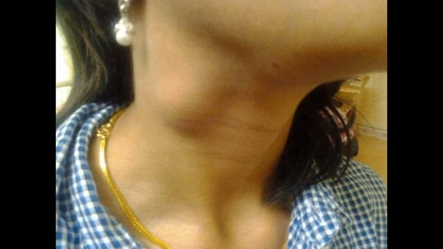 Тема 5.2. Осмотр зубов, миндалин, лимфатических узлов. смотреть онлайн