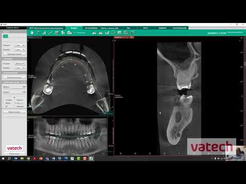 Построение панорамной кривой смотреть онлайн