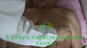 Методика регистрации ЭКГ