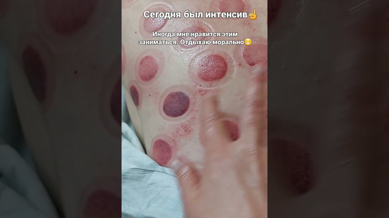 ИНТЕНСИВ ЗДОРОВЬЯ. смотреть онлайн