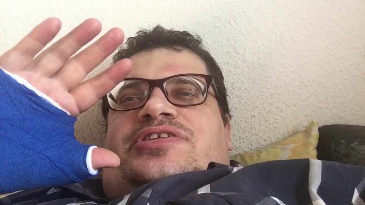 Ушёл на больничный, травма, рука в гипсе смотреть онлайн