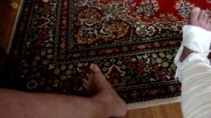 перелом малой берцовой кости