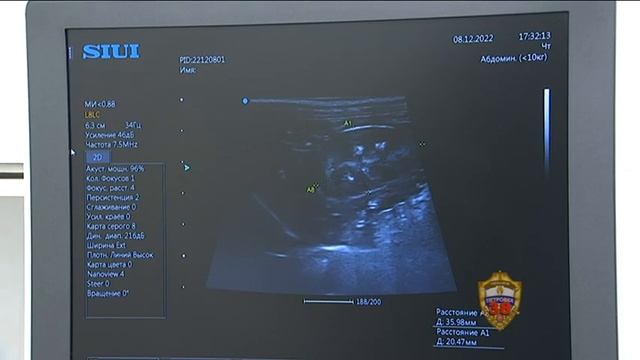 На юго-западе Москвы задержали подозреваемую в жестоком обращении с собакой смотреть онлайн