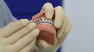 №6.Что делать если отклеился брекет