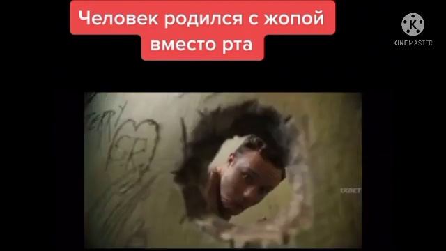 Человек Родился С Жопой Вместо Рта | У Мужика Вместо Рта Выросло Кое Что Другое смотреть онлайн