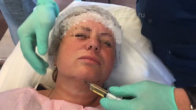 Уход за лицом: чистка и лифтинг