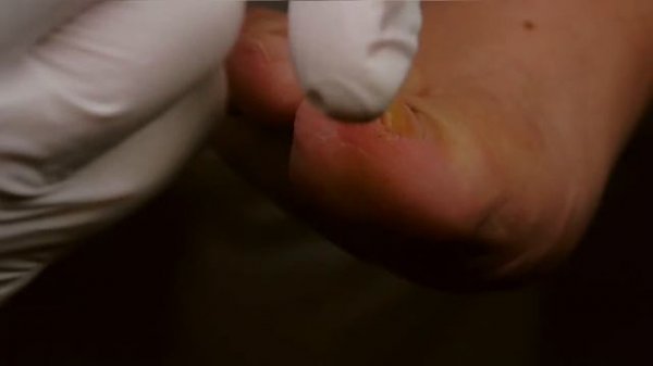 prontoman Spray - Anwendungsvideo