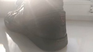 Натирает задник обуви. Что делать? (Коротко и Ясно)