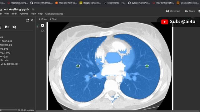 RUNNING SEGMENT ANYTHING MODEL FROM META ON MEDICAL IMAGING DATA | LIVE CODING DEEP LEARNING смотреть онлайн
