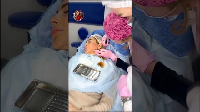 Углы челюсти и скулы. Коррекция иглой и канюлей смотреть онлайн