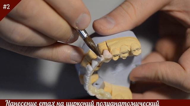 Нанесение керамики emax на циркониевый каркас! Изготовление циркониевых коронок. смотреть онлайн