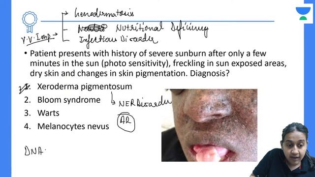 FMGE Dec 2022 | SUPER30 series FMGE PYQs Part 2 | Dermatology | Dr Chesta Aggarwal смотреть онлайн