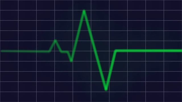 Heart beat monitor HD смотреть онлайн