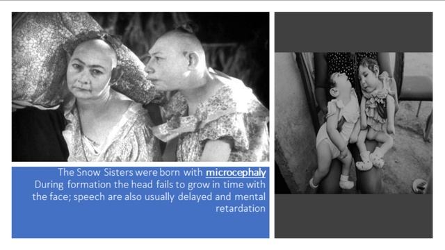 sad story of sisters PIP AND FLIP SNOW – THE PINHEADS OF FREAKS смотреть онлайн