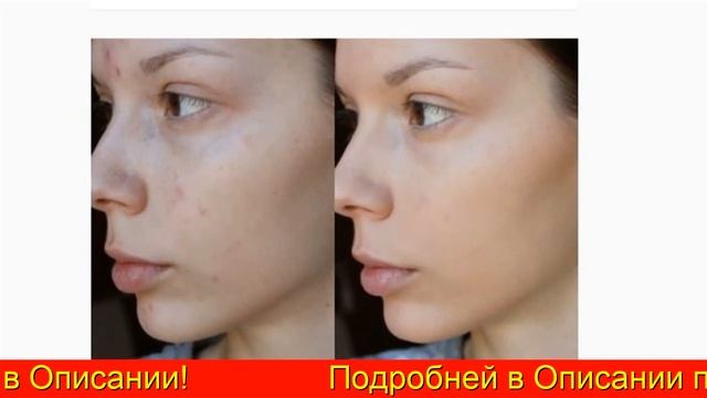 Тональный Крем Ламитон Lamiton Купить В Балашихи смотреть онлайн