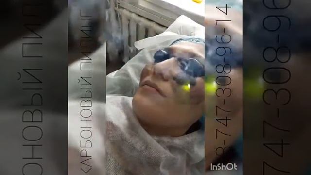Карбоновый пилинг щёчек!) Костанай смотреть онлайн