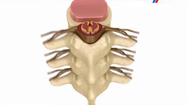 12 04 2017 "ТЕЛЕТЕРАПИЯ" смотреть онлайн